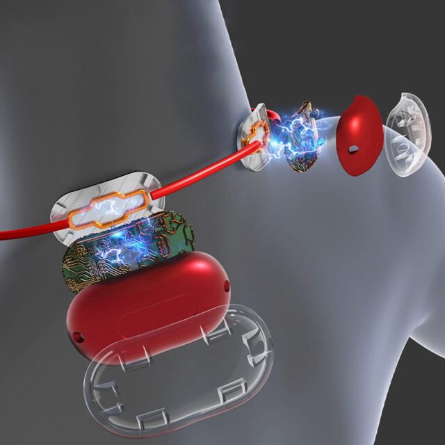 EMS neck and nape muscle massager EMS NECK MASSAGER MT6534 - imagine 7